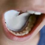 پد جذب رطوبت و بزاق دهان دایرکتا Directa