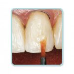 قلم موی کامپوزیت کازمادنت Cosmedent Brushes