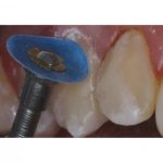 کیت دیسک پرداخت کامپوزیت ۶۰۰ عددی کازمادنت Cosmedent FlexiDisk