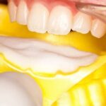 تری فلورایدتراپی یکبارمصرف کوتیزن Cotisen - تری یکبارمصرف فومی فلوراید کوتیزن Cotisen Disposable Fluoride Foam Trays