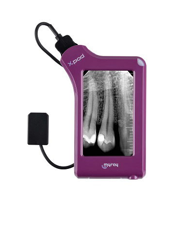 آرویجی RVG MYRAY XPOD - سنسور rvg مای ری My Ray مدل X-Pod سایز 1 - دستگاه RVG مای ری MyRay مدل X-Pod - RVG my ray مدل XPOD