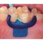 سیلیکون دم برند DMG - قیمت و خرید سیلیکون دم DMG - فروش تجهیزات دندانپزشکی آرمادنت - فروش آنلاین محصولات دندانپزشکی آرمادنت - دندانت