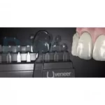 قالب پیش ساخته کامپوزیت UVeneer برند Ultradent - کیت قالب آماده ونیر کامپوزیت UltraDent - Uveneer - قالب پیش ساخته کامپوزیت اولترادنت, قیمت قالب پیش ساخته کامپوزیت, خرید قالب پیش ساخته کامپوزیت,فروش قالب پیش ساخته کامپوزیت, خرید اینترنتی قالب پیش ساخته کامپوزیت اولترادنت, , U Veneer,Ultradent فروش اینترنتی قالب پیش ساخته کامپوزیت, قالب پیش ساخته کامپوزیت ارزان, ارزان ترین قالب پیش ساخته کامپوزیت, قالب پیش ساخته کامپوزیت اصل, بهترین قالب پیش ساخته کامپوزیت